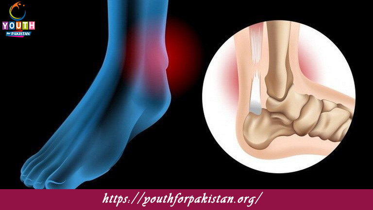 Tendons Quiz with Answers